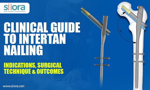 Clinical Guide to Intertan Nailing: Indications, Surgical Technique &&nbsp;Outcomes